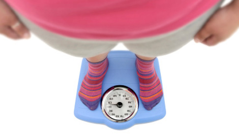 Obesity