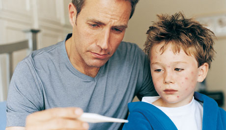 Chicken Pox Treatment Chicken Pox Treatment