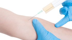 Tuberculin Tuberculin